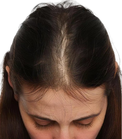 After image 3