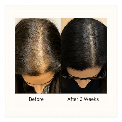 RollBack Roots™ | Hair Regrowth Roller