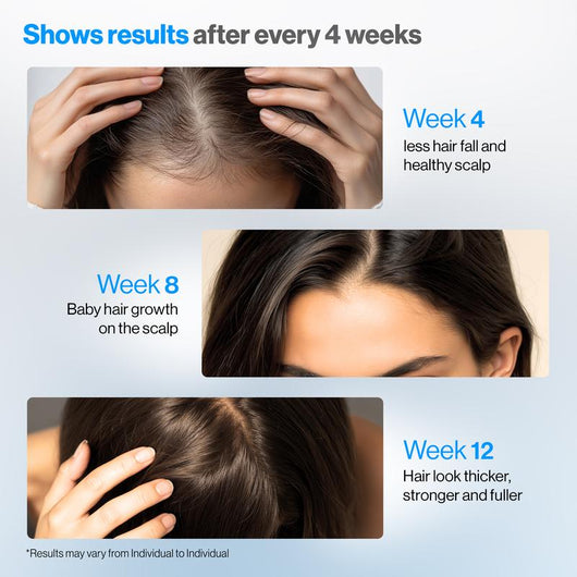 Phyne™ | Hair Growth Roll-On Serum