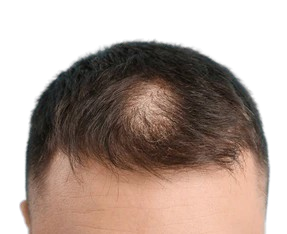 Before image 1