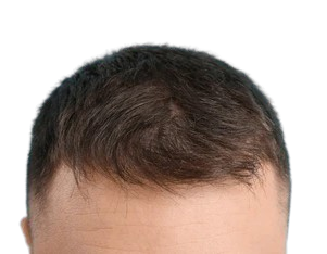 After image 1